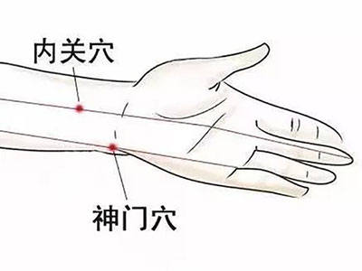 心悸发作症状重，穴位调理需分型