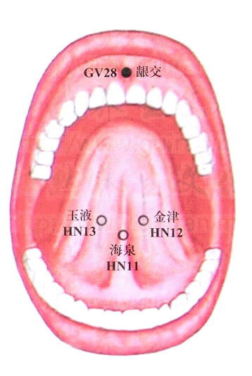 督脉-龈交穴