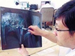 中药名称:﻿﻿﻿银柴胡